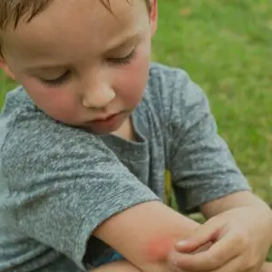 A young boy sitting on the grass with his arm in an elbow.