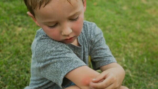 A young boy sitting on the grass with his arm in an elbow.